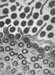 M,22y. | normal bronchial epithelium M,22y. | normal bronchial epithelium
